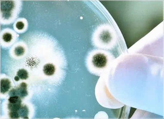 As análises microbiológicas em alimentos