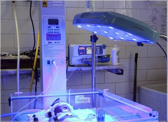 O desempenho dos equipamentos de fototerapia para recém-nascido