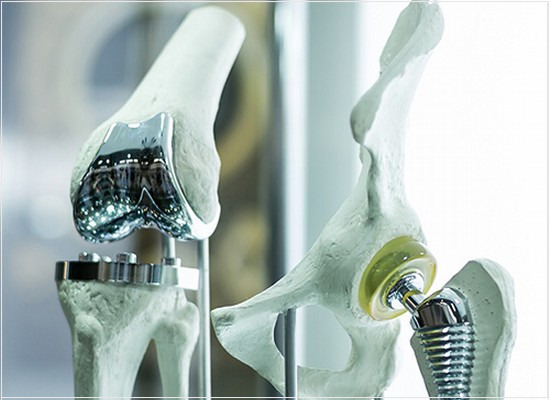 Os documentos de inspeção dos implantes para cirurgia