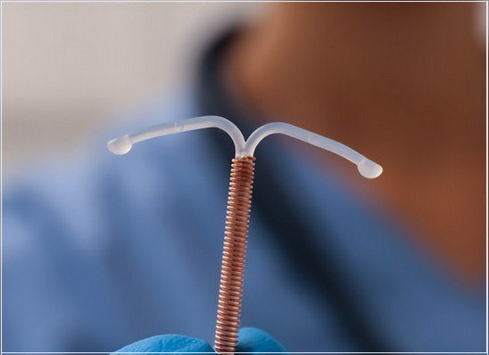 A conformidade dos dispositivos intrauterinos contraceptivos de cobre