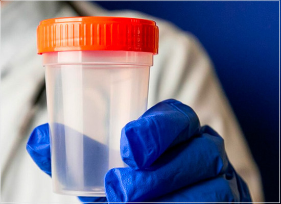 As especificações normativas para o exame de fezes em laboratórios clínicos