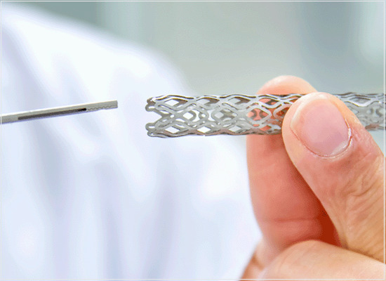 A avaliação dos sistemas de stents vasculares