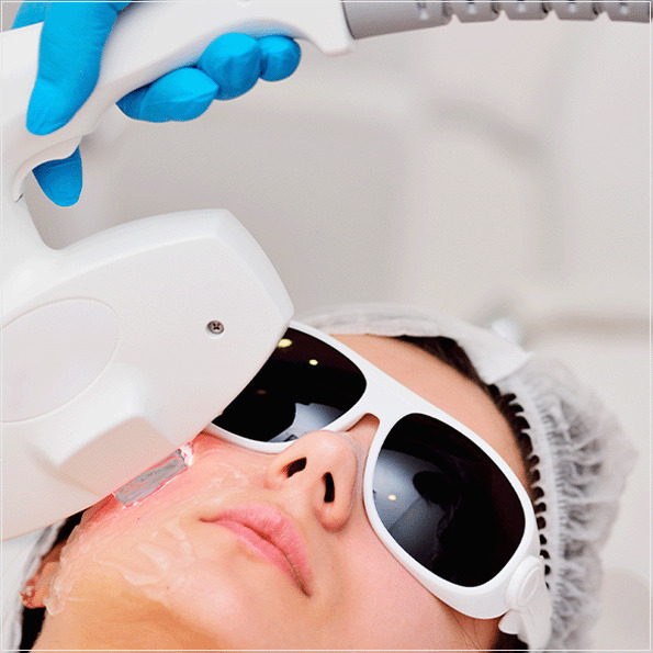 IEC TS 60825-20: a segurança de produtos da exposição do rosto ou dos olhos à radiação laser