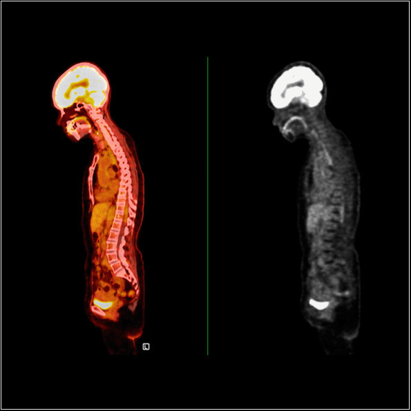 As características normativas dos tomógrafos por emissão de pósitrons